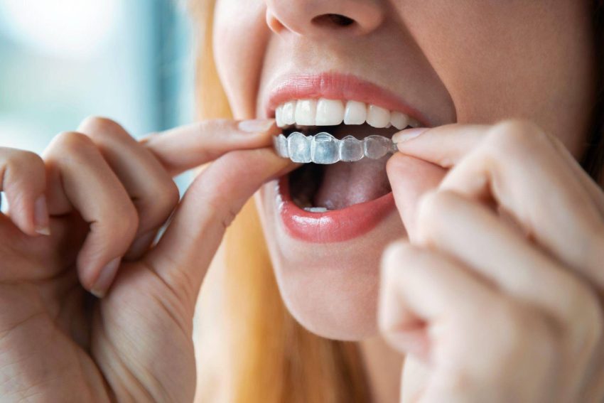 Whiter Teeth: Exploring the Science Behind Modern Whitening Methods